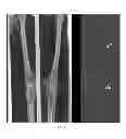 Fig. 06 - Method to detect and indicate inaccuracies in long length imaging
