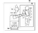 Fig. 01 - PORTABLE X-RAY DIAGNOSTIC APPARATUS