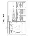 Fig. 12 - PORTABLE X-RAY DIAGNOSTIC APPARATUS