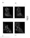 Fig. 07 - System and method of predicting future fractures