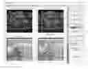 Fig. 01 - Statistical mapping in an optoacoustic imaging system