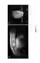 Fig. 07 - Magnetic resonance imaging cell labeling methods and compositions