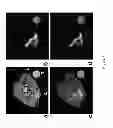 Fig. 09 - Magnetic resonance imaging cell labeling methods and compositions