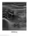 Fig. 09 - Method for treating and confirming diagnosis of exertional compartment syndrome