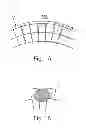 Fig. 02 - Compositions, methods and kits for remineralization and inhibition of dental caries in teeth