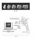 Fig. 35 - Compositions, methods and kits for remineralization and inhibition of dental caries in teeth