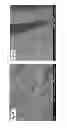 Fig. 20 - Amphiphilic linear peptidepeptoid and hydrogel comprising the same