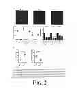 Fig. 03 - Suppression of bone loss by introducing FoxP3+ CD8 T-cells (Tc)
