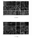 Fig. 26 - Modulating bacterial MAM polypeptides in pathogenic disease