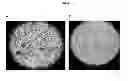 Fig. 05 - Novel Mensenchymal Stem Cells And Bone-Forming Cells