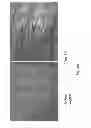 Fig. 07 - Methods and apparatuses for isolating and preparing stem cells