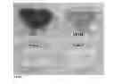 Fig. 06 - Synergistic antimicrobial effect