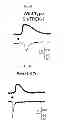 Fig. 40 - Method for screening a glutamate release inhibitor in an astrocyte