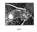 Fig. 04 - METHODS FOR PANCREATIC TISSUE REGENERATION