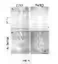 Fig. 11 - METHODS FOR PANCREATIC TISSUE REGENERATION
