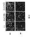 Fig. 13 - METHODS FOR PANCREATIC TISSUE REGENERATION