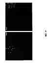 Fig. 18 - METHODS FOR PANCREATIC TISSUE REGENERATION