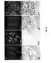 Fig. 19 - METHODS FOR PANCREATIC TISSUE REGENERATION