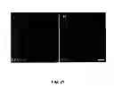 Fig. 22 - METHODS FOR PANCREATIC TISSUE REGENERATION