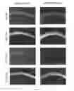 Fig. 31 - VEGF-D/VEGFR2/3-mediated regulation of dendrites
