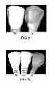 Fig. 04 - Solid oral sensorial products including stain inhibitor