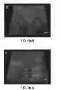 Fig. 14 - Nanoparticle - Biocide Treatment of Biofilms