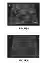 Fig. 16 - Nanoparticle - Biocide Treatment of Biofilms