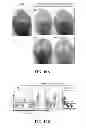 Fig. 13 - EXOSOMAL COMPOSITIONS AND METHODS FOR THE TREATMENT OF DISEASE