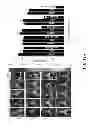 Fig. 18 - EXOSOMAL COMPOSITIONS AND METHODS FOR THE TREATMENT OF DISEASE