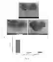 Fig. 09 - NON-ENTERIC COATED PHARMACEUTICAL COMPOSITION AND USE THEREOF