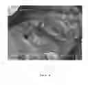 Fig. 19 - Highly compactable and durable direct compression excipients and excipient systems
