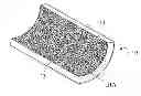 Fig. 01 - Method for modification of the surface and subsurface regions of metallic substrates