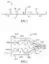 Fig. 02 - Film with alternating stripes and strands and apparatus and method for making the same