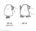 Fig. 02 - ACTIVE MATERIAL COMPOSITIONS COMPRISING HIGH SURFACE AREA CARBONACEOUS MATERIALS