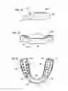 Fig. 03 - Repositioning Appliance