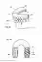 Fig. 04 - Repositioning Appliance