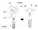 Fig. 01 - BUTTON FOR IMPLNAT HEALING ABUTMENT AND IMPLANT HEALING ABUTMENT HAVING PRESSING PART