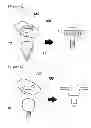 Fig. 04 - BUTTON FOR IMPLNAT HEALING ABUTMENT AND IMPLANT HEALING ABUTMENT HAVING PRESSING PART