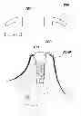 Fig. 06 - BUTTON FOR IMPLNAT HEALING ABUTMENT AND IMPLANT HEALING ABUTMENT HAVING PRESSING PART