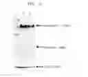 Fig. 06 - Compositions, kits, and methods for isolating vesicles