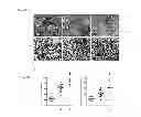 Fig. 11 - Method of anaerobic tissue-targeted gene expression initiated by alcohol dehydrogenase promoter and the application thereof