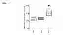 Fig. 12 - Method of anaerobic tissue-targeted gene expression initiated by alcohol dehydrogenase promoter and the application thereof
