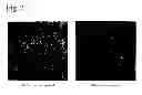 Fig. 03 - Microbial cell and particle selection system and method of use