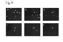 Fig. 10 - Microbial cell and particle selection system and method of use