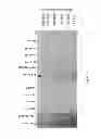 Fig. 20 - Expression systems and methods of producing spider silk proteins