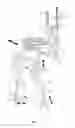 Fig. 06 - Active robotic gait-training system and method