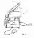 Fig. 03 - Biasing fitness chair