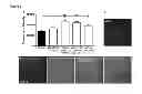 Fig. 09 - High-affinity, dimeric inhibitors of PSD-95 as efficient neuroprotectants against ischemic brain damage and for treatment of pain