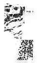 Fig. 02 - METHODS FOR TRANSDIFFERENTIATION OF BODY TISSUES