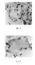 Fig. 04 - Use of dextran sulfate